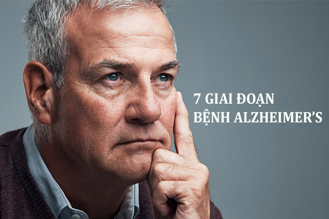 cac giai doan benh Alzheimer