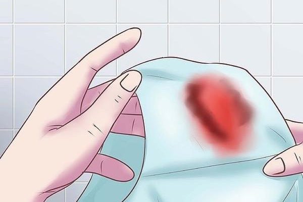10 nguyên nhân gây chảy máu sau quan hệ ở nữ giới