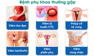 khi-nao-nen-di-kham-phu-khoa-kham-o-dau-tai-ha-noi